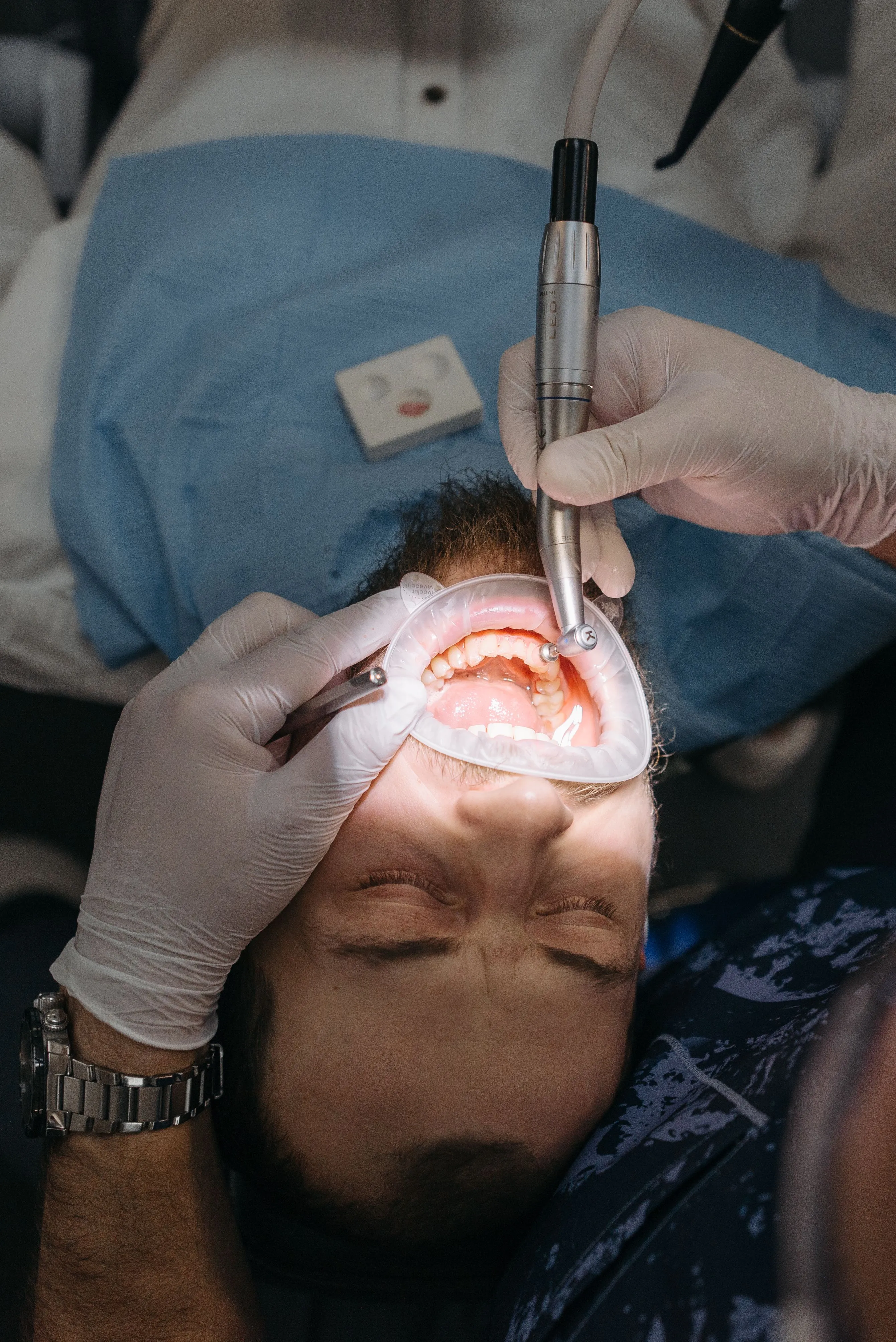 Procedimento odontológico com afastador labial e caneta de alta rotação